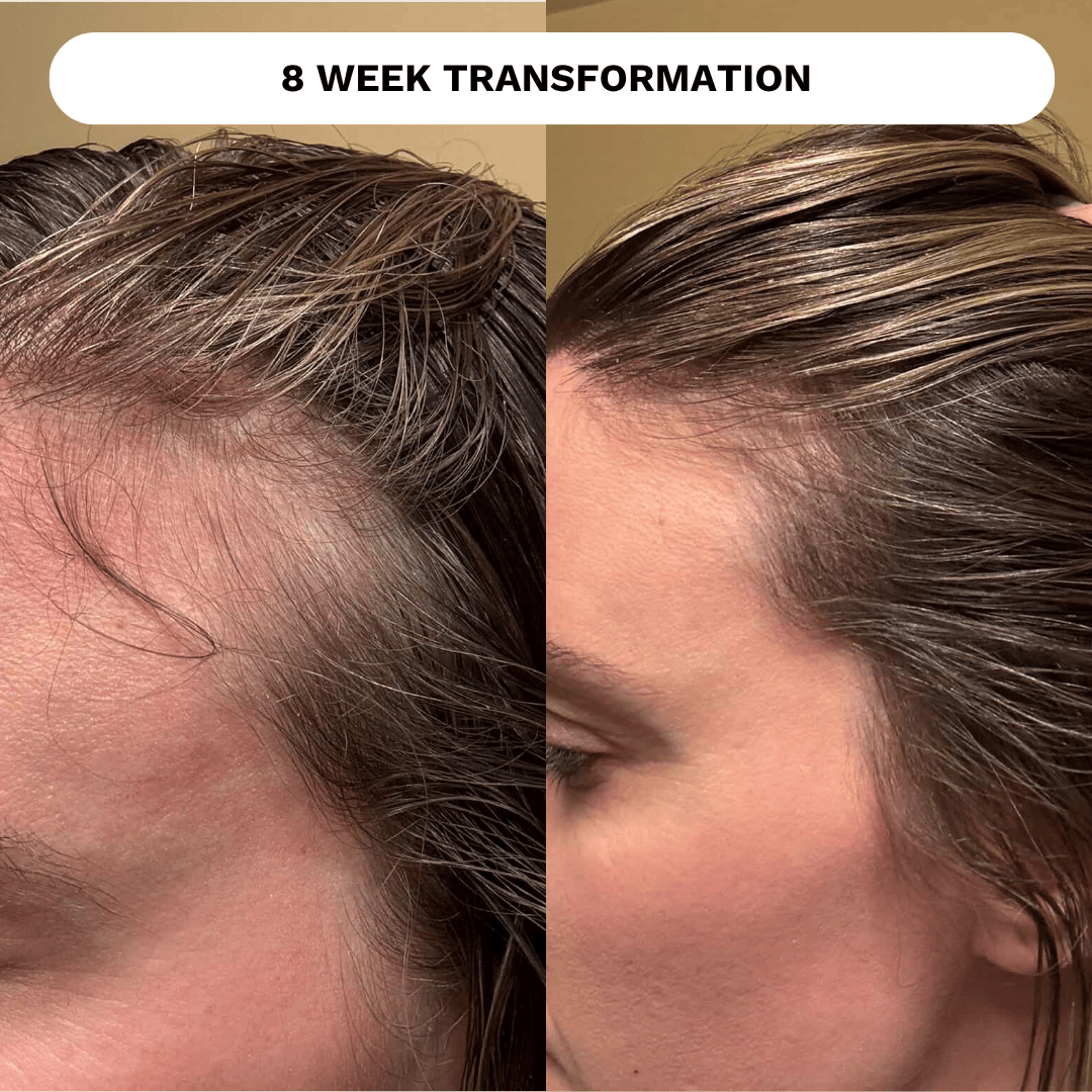 Evatasha Hair Care Hair Renewal Bundle