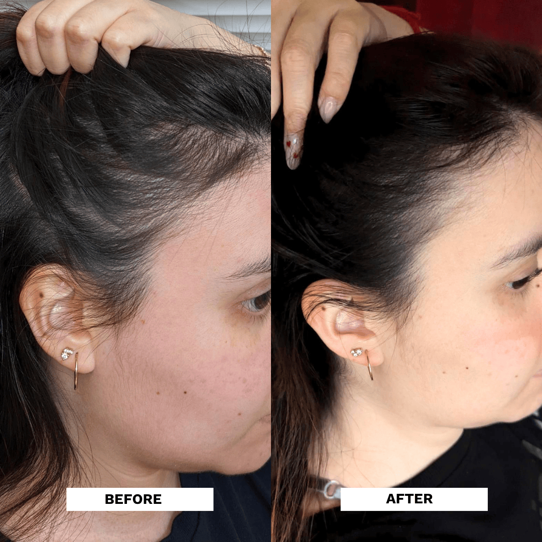 Evatasha Hair Care Hair Renewal Bundle