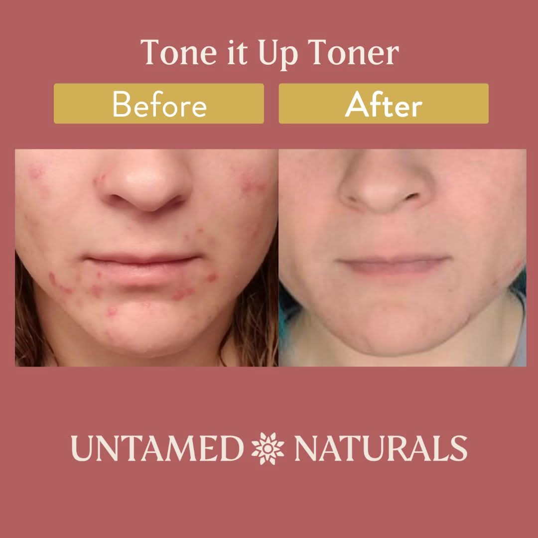 UnTamed Naturals All Products Tone It Up! Toner
