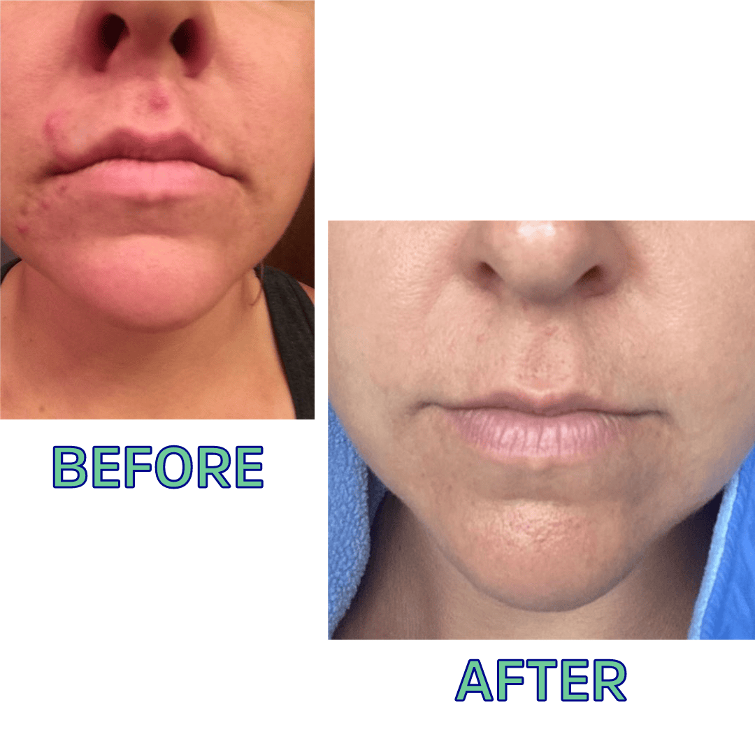 FATCO Skincare Products Cleansing Oil For Normal/Combo Skin 4 Oz