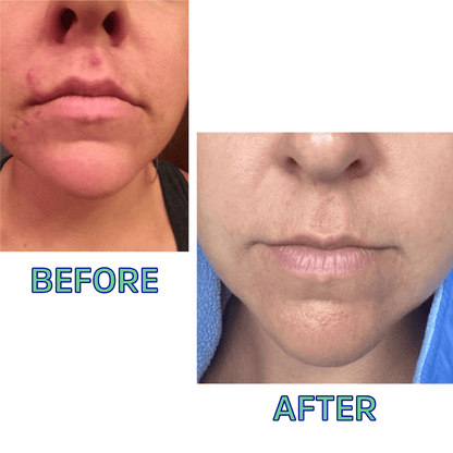 FATCO Skincare Products Cleansing Oil For Normal/Combo Skin 4 Oz